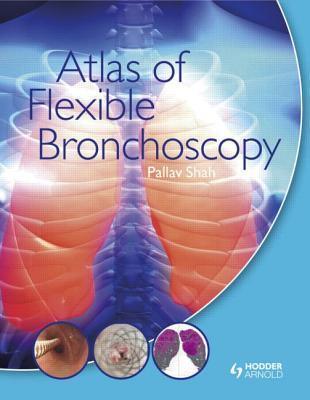 Atlas of Flexible Bronchoscopy - Thryft