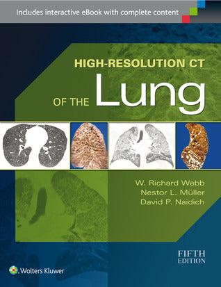 High-Resolution CT of the Lung - Thryft
